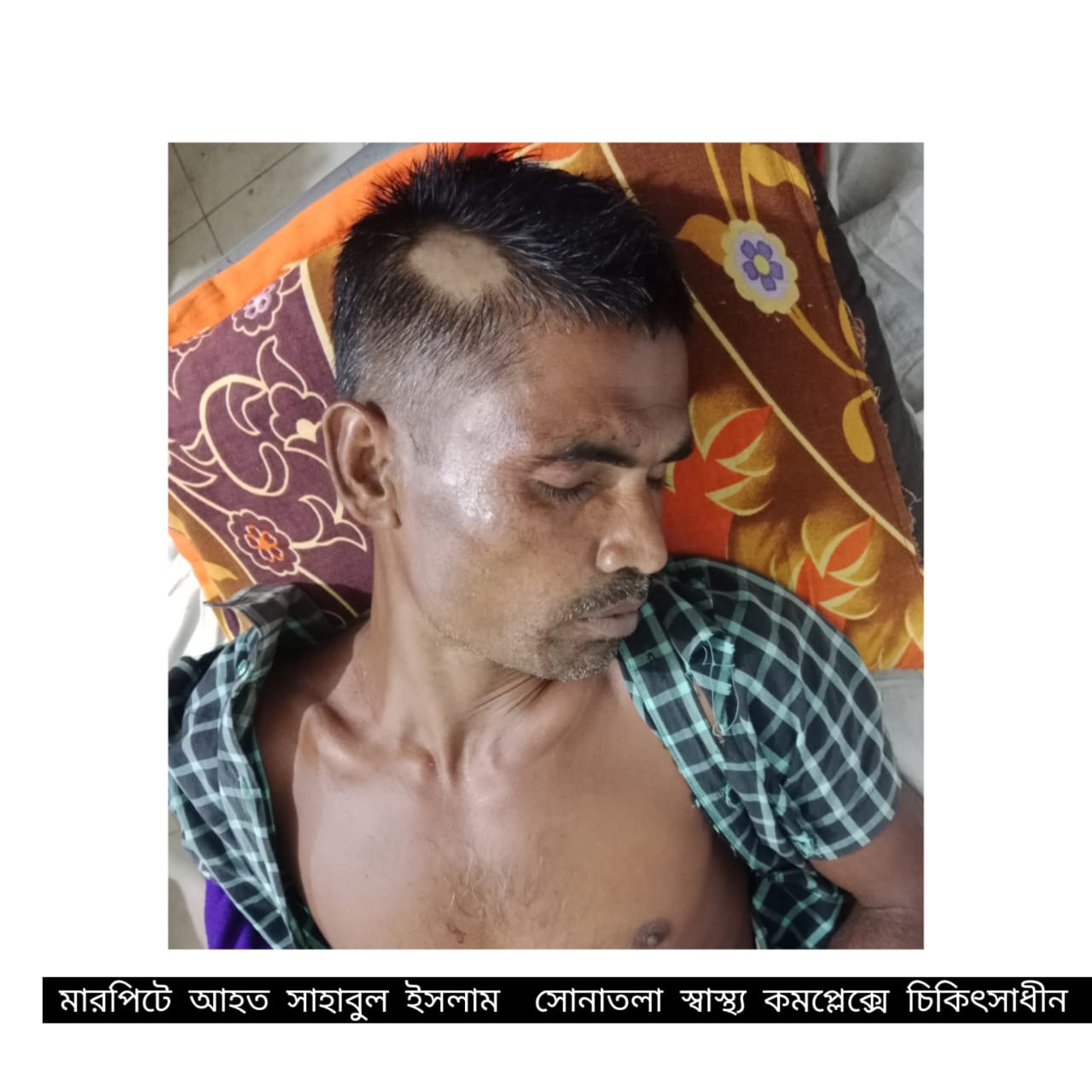 সোনাতলায় অর্থ লেনদেনের জেরে মারপিটের ঘটনায় : থানায় অভিযোগ।।