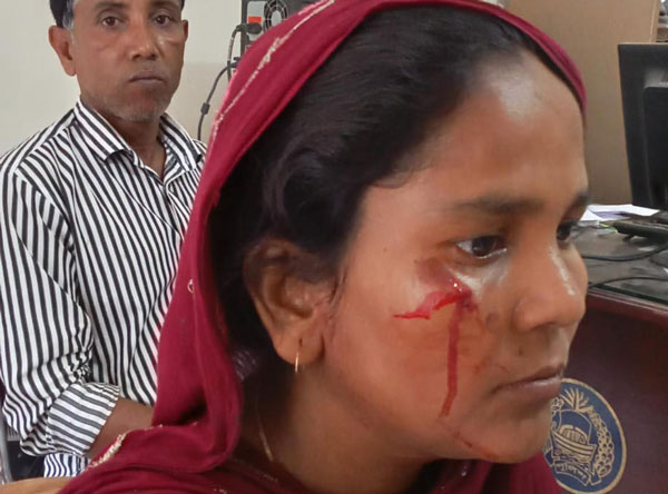 বাঘায় প্রতিবেশির মারপিটে আহত আনসার ভিডিপির দলনেত্রী
