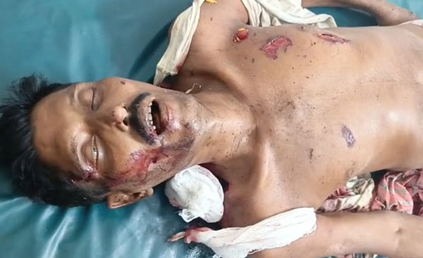 দলীয় প্রতিপক্ষের বোমা হামলার বেনাপোলে বিএনপি কর্মি নিহত দলীয় প্রতিপক্ষের বোমা হামলার বেনাপোলে বিএনপি কর্মি নিহত
