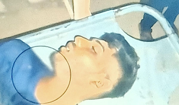 শার্শায় দূর্বৃত্তদের ছুরিকাঘাতে ২ হতাহত শার্শায় দূর্বৃত্তদের ছুরিকাঘাতে ২ হতাহত
